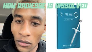How Radiesse (a Permanent Filler) is Dissolved