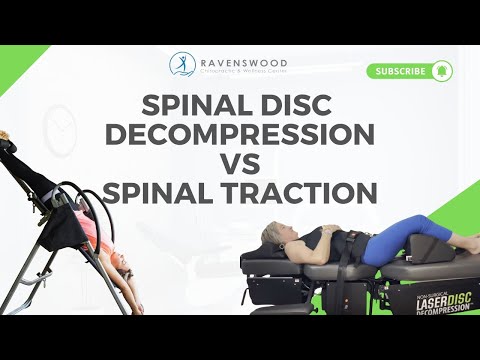 Spinal Decompression vs Spinal Traction