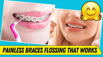 How to Floss with Braces WITHOUT Pain 🦷 (Easy & Fast Guide)