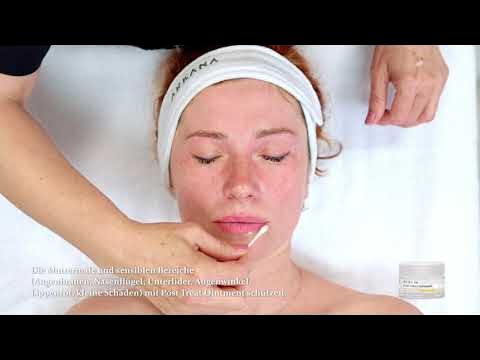 Bernstein-Glykol-Peeling-Behandlung mit Vitamin C und Curcumin- C Fusion Glow DE - YouTube
