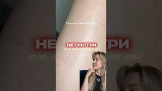 Гусиная кожа — это не приговор, а сигнал, что коже нужен правильный уход 🤍