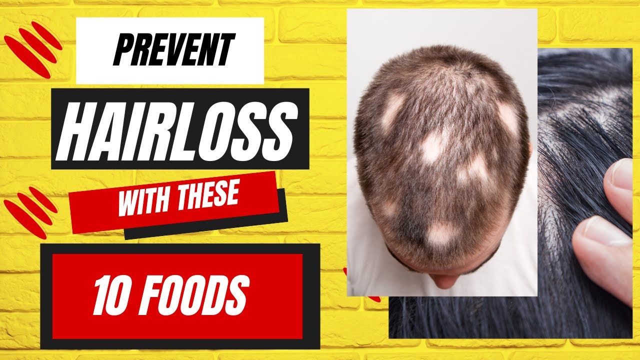 Top 10 FOODS to prevent HAIR LOSS !