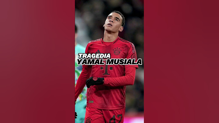 Tragedia, Yamal musiala se lesiona de gravedad en el Psg- Bayer 😱❗❗#musiala #lesion