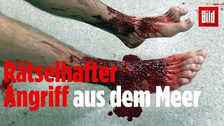 Blutende Beine - Werflöhe Haben Diese Füße So Zugerichtet