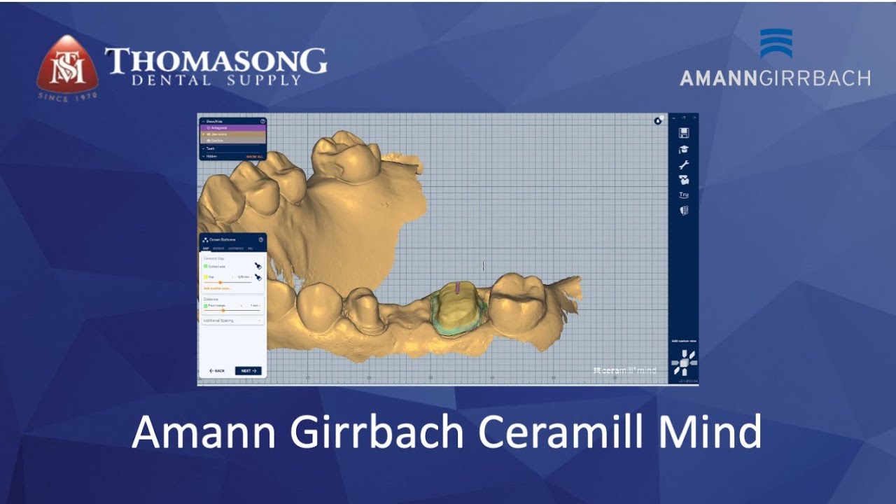 Amann Girrbach CAD Software : Ceramill Mind - YouTube
