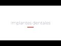 Implantes dentales en bordon clinic