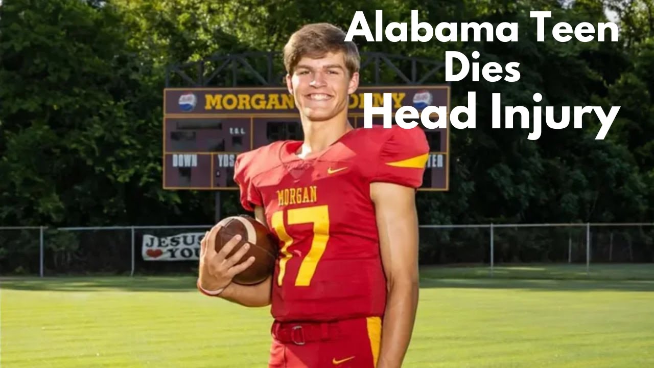 Alabama Teen Dies After Head Injury During High School Football Game # ...