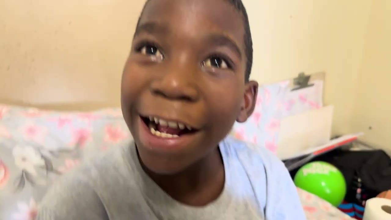 Já se Passaram 16 Dias da Cirurgia do Nózio – Veja a Evolução