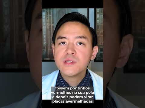 Vídeo: Como reconhecer herpes: 10 etapas (com imagens)