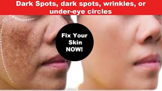 Wrinkles, Sagging & Dark Circles? Let’s Fix Them Together,
