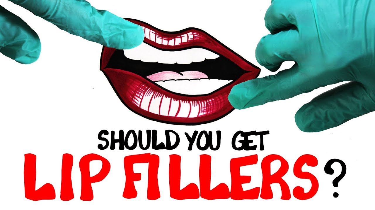 Should You Get Lip Fillers? Should You Get Lip Fillers?
