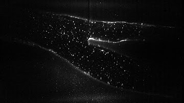 PIV Raw images Carotid Bifurcation