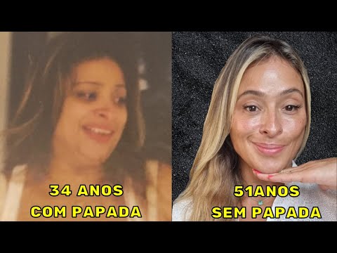 Vídeo: 3 maneiras de se livrar de furúnculos