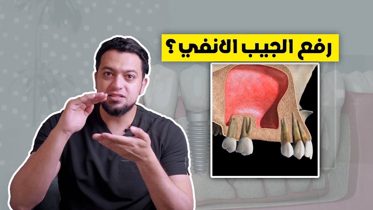 يعني ايه رفع الجيب الانفي؟ || د. زراعة - الحلقة الثامنة(٨)