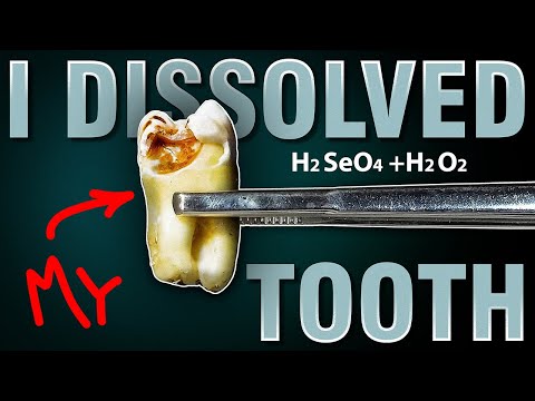 I Dissolved My Tooth in SELENIC Piranha!