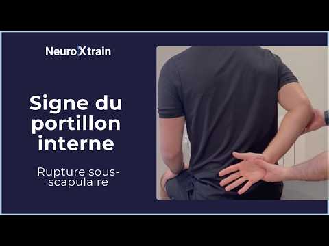 Signe du portillon interne