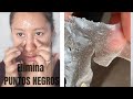 mascarilla para ELIMINAR PUNTOS NEGROS con GELATINA | Eliminar puntos negros 100% efectivo