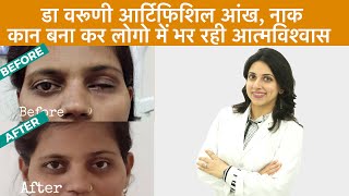 नकली आँख, कान, नाक अंग असली दिखते है, होता है आत्मविश्वास का सृजन Dr Varuni Arora | Prosthodontist