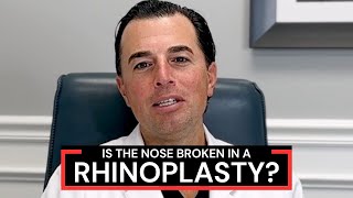 What Is Osteotomy During Rhinoplasty Nose Job Surgery? Dr. Anthony Corrado