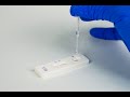 Procedure for Total Aflatoxin Quantitative Test Kit for Feed and Grains