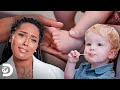Bebê nasce com seis dedos em cada pé | Meus Pés Estão Me Matando | Discovery Brasil