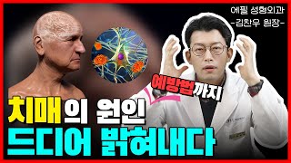 노인성 3대질환 치매! 치매의 원인과 치매 예방법 궁금하셨죠? 이 영상으로 확인하세요