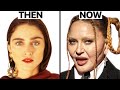 Madonna Plastic Surgeries - Surgeon Reacts