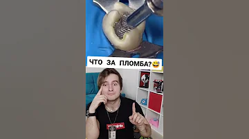 ЧЕРНЫЕ ПЛОМБЫ ИЗ АМАЛЬГАМЫ? ПОЧЕМУ ВРЕДНЫ?  #Shorts