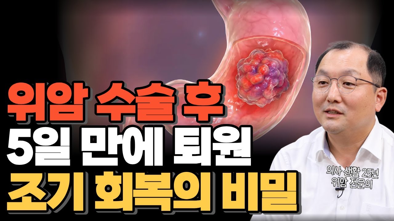 위암 수술 후 5일 만에 퇴원? 25년 차 명의가 말하는 '조기 회복'의 비밀