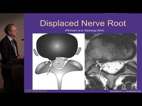 Video: Imbasan MRI Lumbar: Tujuan, Prosedur, Dan Risiko