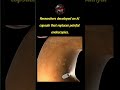 Researchers Develop AI Capsule That Could Replace Painful Endoscopies #shorts #ai #history