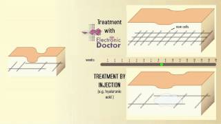 Treatment with Electronic Doctor / Treatment by Injection - Comparison - 16 weeks timeframe screenshot 4