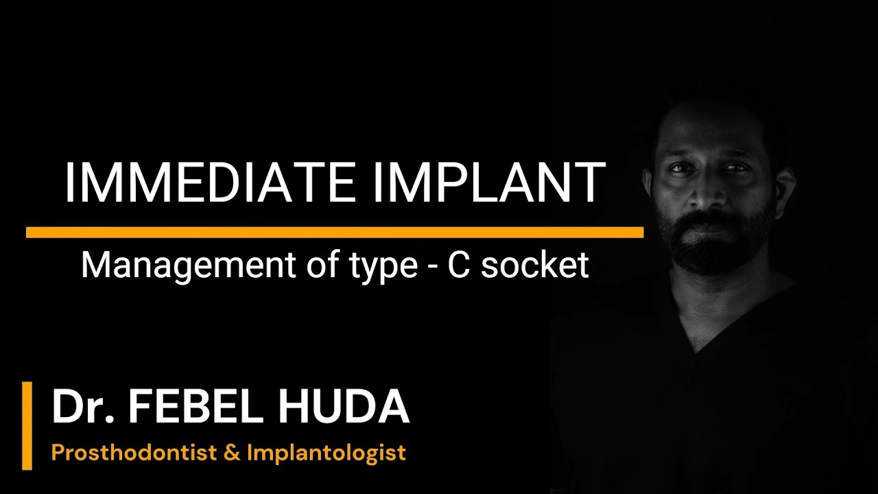 MANAGEMENT OF TYPE C SOCKET IMMEDIATE IMPLANT PLACEMENT YouTube MANAGEMENT OF TYPE C SOCKET IMMEDIATE IMPLANT PLACEMENT YouTube