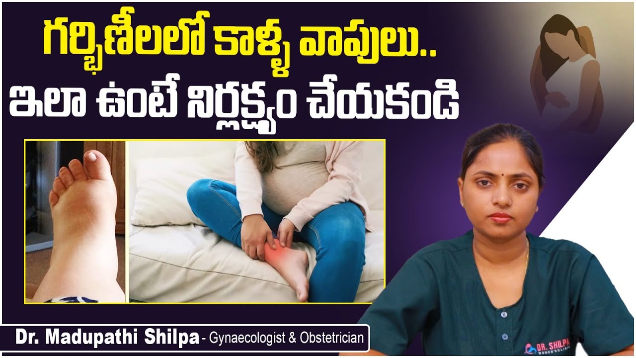 గర్భిణీల్లో కాళ్ల వాపులు ప్రమాదమా? || Leg Swelling During Pregnancy in Telugu || Edema || Dr. Shilpa