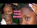 STOP RIPPING OUT YOUR EDGES! | How To PROPERLY Remove A Lace Frontal Install