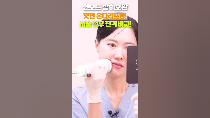 Ep.7 인모드 상위호환 핫한 온다리프팅! 시술 전후 전격 비교! 부천피부과 #Shorts