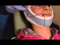 Second Stage-p3 of MewVector Orthodontic Orthotropics Headgear (Head Brace) Preparation- Dr Mike Mew