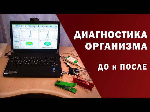 Компьютерная диагностика организма.