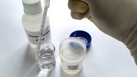 Semen Analysis Test Lab | Sperm Count Test