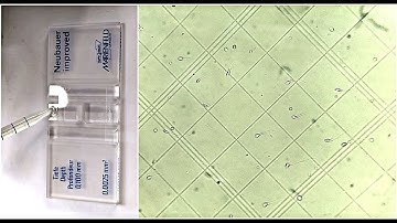 Semen Analysis Test Lab | Sperm Count Test