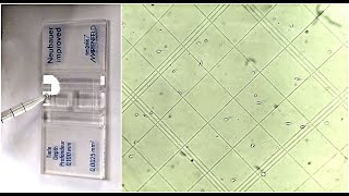 Semen Analysis Test Lab | Sperm Count Test