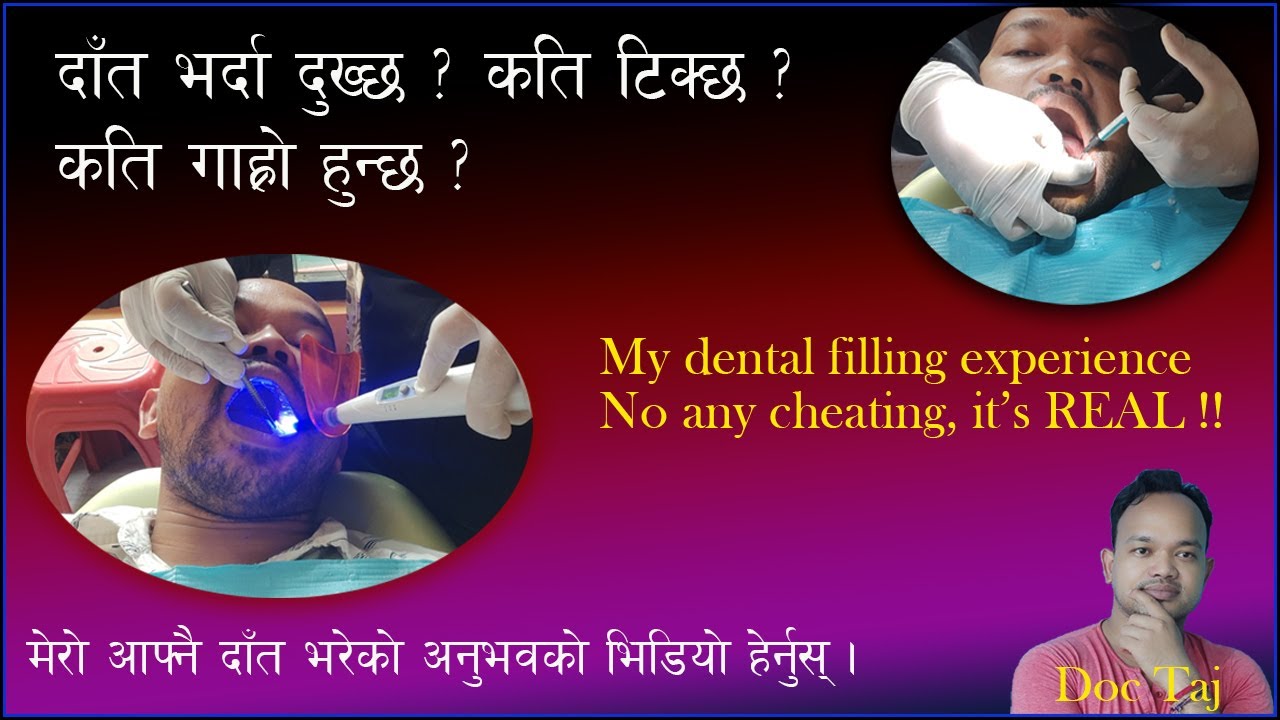 Dental/Teeth filling/Restoration/Teeth filling Vlog/Genuine response