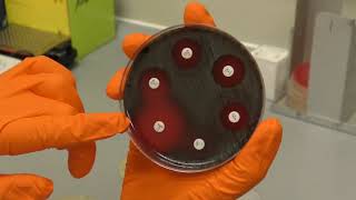 How to read an antibiotic disc sensitivity plate