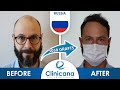 Alexey's Hair Transplant Journey in Istanbul Turkey | Clinicana reviews