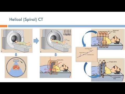 Video: Spiralcomputertomographie