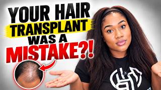 Why Your Hair Transplant Failed (And How To Fix It!) #Hairtransplant #hairlosstreatment  #hairloss