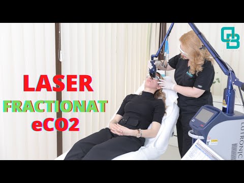 Laser eCO2 Fractionat | Testimonial Dr. Dana Bratu