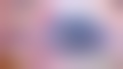 Best video for learning Iris hook technique ,  case of Glaucoma and corneal dystrophy Dr Kamal Kapur