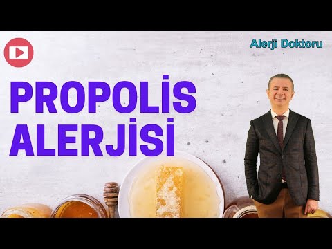 Video: Ağız qoruyucuma alerjim ola bilərmi?