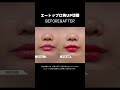 口角手術の症例💋